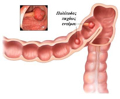 colon3