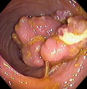 colon4