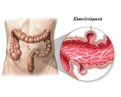 colon5